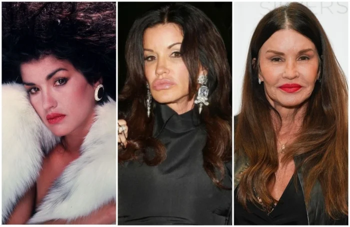 Когда стремление к молодости обернулось бедой: звезды, испортившие свою внешность