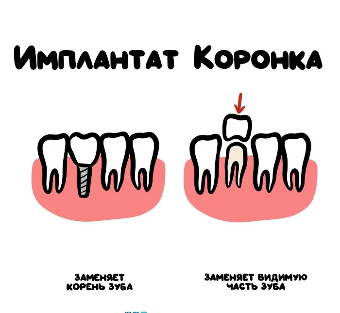 Знай разницу! Различий пост #67