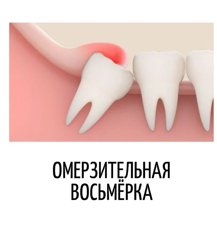 Игра слов #93