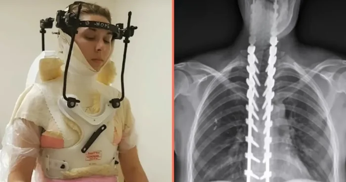 Женщина, пережившая “внутреннее обезглавливание”: удивительная история спасения