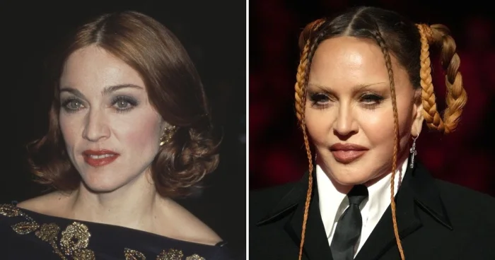 Звёзды, которые открыто признались в разочаровании от пластики