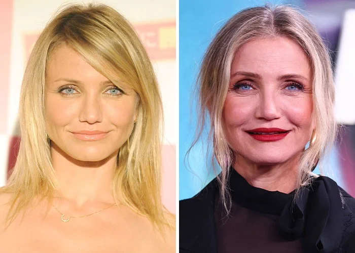 Звёзды, которые открыто признались в разочаровании от пластики