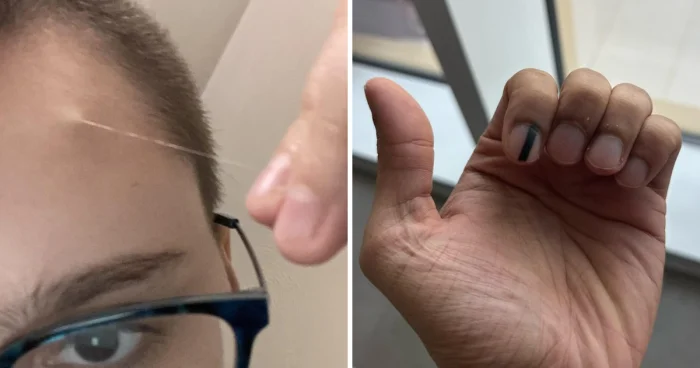 15 уникальных людей с редкими особенностями внешности