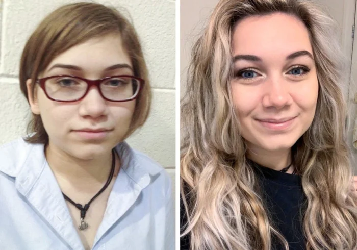 20 случаев, когда «гадкие утята» превратились в настоящих красавцев