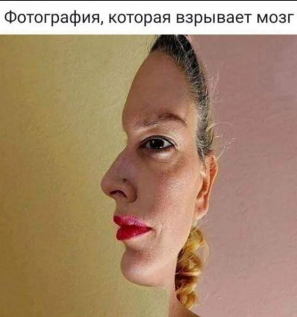 Активная баянизация