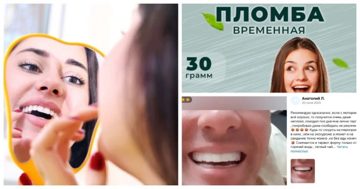 Из-за роста цен на стоматологов россияне начали покупать наборы для самостоятельных пломб