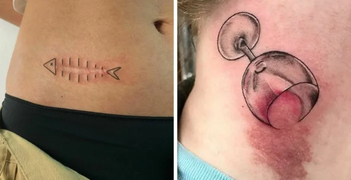 Гениальные идеи тату: 16 примеров маскировки шрамов