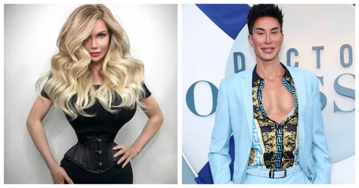 20 людей, ставших знаменитыми после пластических операций