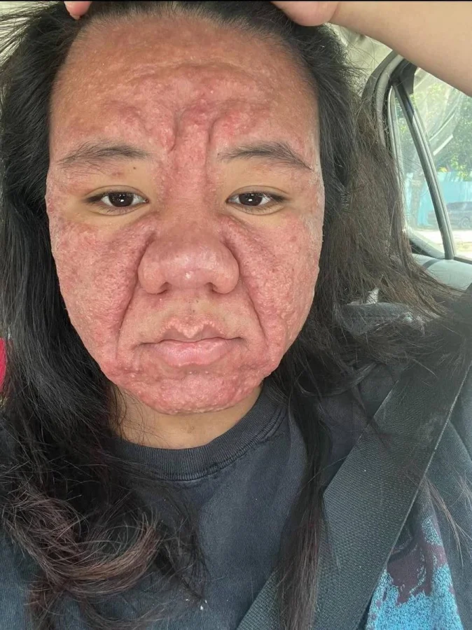 Беременность изменила 28-летнюю девушку до неузнаваемости