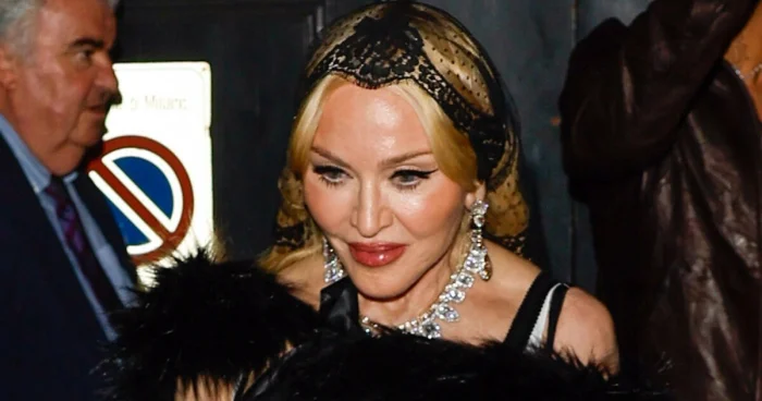 25 знаменитостей без макияжа и фотошопа: как они выглядят на самом деле