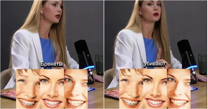 Брекеты без страха: мифы и правда о возможных рисках
