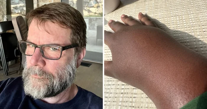 Когда тело подбрасывает сюрпризы: 12 необычных случаев