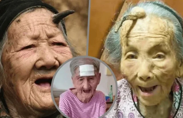 Китаянка решила отрезать «рог долголетия» — вот что произошло