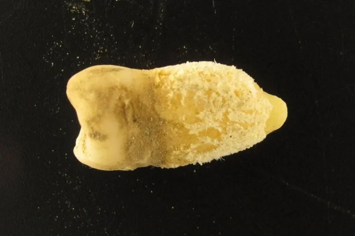 Боливийская мумия переписала историю скарлатины — Колумб оказался не виноват