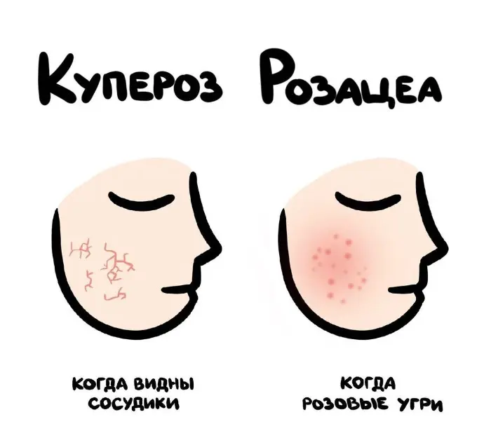 Слова, которые часто путают: в чём разница #84