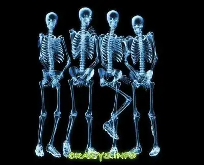 &gt;&gt;Click to zoom image&lt;&lt;